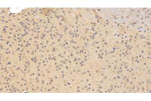 Detection of TNFRSF21 in Mouse Cerebrum Tissue using Polyclonal Antibody to Tumor Necrosis Factor Receptor Superfamily, Member 21 (TNFRSF21)