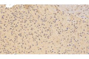 Detection of TNFRSF21 in Mouse Cerebrum Tissue using Polyclonal Antibody to Tumor Necrosis Factor Receptor Superfamily, Member 21 (TNFRSF21) (TNFRSF21 anticorps  (AA 406-605))