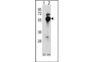 Western blot analysis of DARS (arrow) using DARS1 Antibody (N-term) Cat. (DARS anticorps  (N-Term))