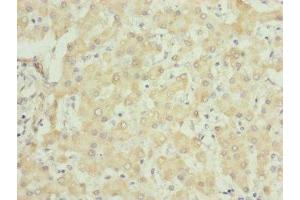 Immunohistochemistry of paraffin-embedded human liver tissue using ABIN7149102 at dilution of 1:100