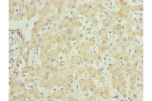 Immunohistochemistry of paraffin-embedded human liver tissue using ABIN7149102 at dilution of 1:100 (UQCRC1 anticorps  (AA 156-480))
