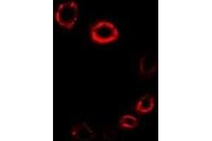 Immunofluorescent analysis of HMGCR staining in A549 cells. (HMGCR anticorps)