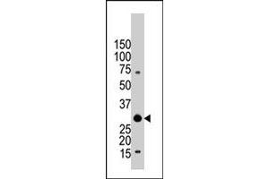 The YWHAB polyclonal antibody  is used in Western blot to detect YWHAB in Jurkat cell lysate. (YWHAB anticorps  (C-Term))