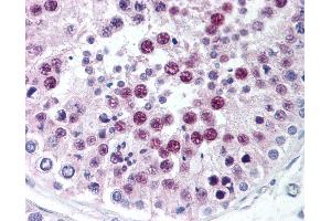 Anti-SIRT1 antibody IHC of human testis. (SIRT1 anticorps  (C-Term))