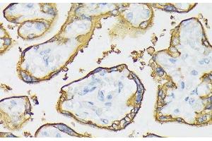 Immunohistochemistry of paraffin-embedded Human placenta using ALPP Polyclonal Antibody at dilution of 1:100 (40x lens). (PLAP anticorps)
