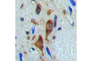 Immunohistochemical analysis of Histone Deacetylase 6 (pS22) staining in human brain formalin fixed paraffin embedded tissue section. (HDAC6 anticorps  (N-Term, pSer22))