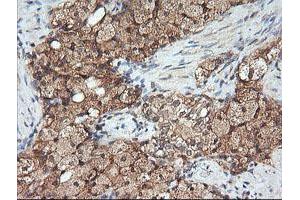 Image no. 5 for anti-Mitogen-Activated Protein Kinase Kinase 1 (MAP2K1) antibody (ABIN1499388) (MEK1 anticorps)