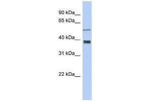 WB Suggested Anti-SS18L1 Antibody Titration: 0. (SS18L1 anticorps  (Middle Region))