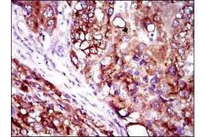 Immunohistochemistry (IHC) image for anti-Solute Carrier Family 27 (Fatty Acid Transporter), Member 2 (SLC27A2) (AA 346-405) antibody (ABIN1845739)