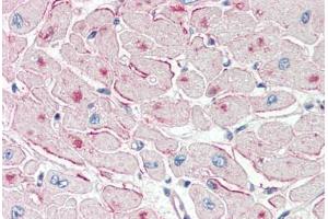 Human Heart (formalin-fixed, paraffin-embedded) stained with PNPLA2 antibody ABIN337131 at 2. (PNPLA2 anticorps  (AA 68-79))