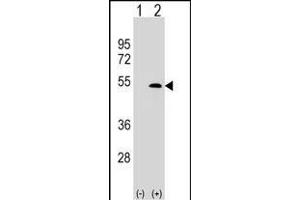 Western blot analysis of XLKD1 (arrow) using rabbit polyclonal XLKD1 Antibody (C61) (ABIN388751 and ABIN2839014).