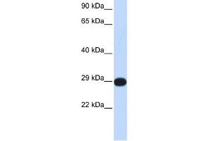 WB Suggested Anti-PPP4C Antibody Titration: 0. (PPP4C anticorps  (Middle Region))