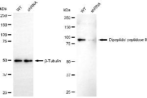Western blotting analysis using dipeptidyl peptidase 9 antibody (ABIN7798347). (DPP9 anticorps)