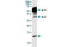 anti-Chemokine (C-C Motif) Ligand 18 (Pulmonary and Activation-Regulated) (CCL18) (AA 1-89) antibody