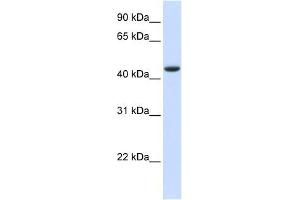 TRDMT1 antibody used at 1 ug/ml to detect target protein. (Dnmt2 anticorps  (N-Term))