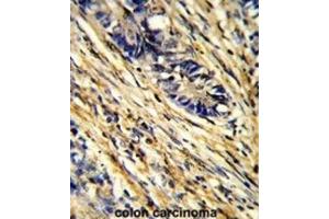 Immunohistochemistry (IHC) image for anti-14-3-3 gamma (YWHAG1) antibody (ABIN3001731) (14-3-3 gamma anticorps)