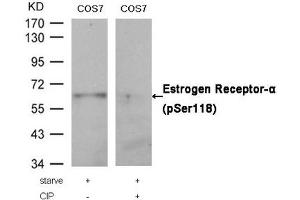 Western blot analysis of extracts from COS7 cells, treated with starve or calf intestinal phosphatase (CIP), using Estrogen Receptor-α (Phospho-Ser118) Antibody. (Estrogen Receptor alpha anticorps  (pSer118))