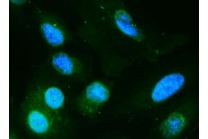 IF analysis of DIO1 using anti-DIO1 antibody (ABIN7599988).