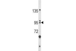 Western Blotting (WB) image for anti-Bicaudal C Homolog 1 (BICC1) antibody (ABIN3002907) (BICC1 anticorps)