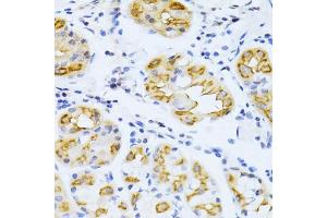 Immunohistochemistry of paraffin-embedded human stomach using CYP2E1 antibody (ABIN3023078, ABIN3023079, ABIN3023080 and ABIN6219379) at dilution of 1:100 (40x lens). (CYP2E1 anticorps  (AA 234-493))