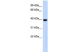 WB Suggested Anti-AURKC Antibody Titration: 0. (Aurora Kinase C anticorps  (Middle Region))