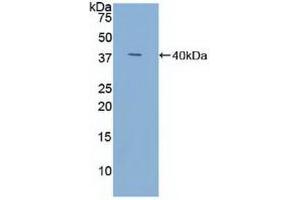 Western blot analysis of recombinant Human TFF3. (TFF3 anticorps  (AA 22-94))
