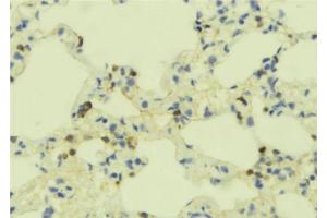ABIN6273355 at 1/100 staining Mouse lung tissue by IHC-P.
