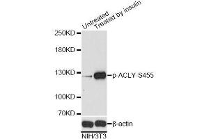 Western blot analysis of extracts of NIH/3T3 cells,using Phospho-ACLY-S455 antibody.