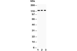 Western blot testing of PLD1 antibody and Lane 1:  mouse heart;  2: 22RV1;  3: HeLa;  Predicted size: 124KD;  Observed size: 124KD (PLD1 anticorps  (AA 1-330))