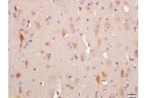 Formalin-fixed and paraffin embedded rat brain labeled with Rabbit Anti-ADCY10 Polyclonal Antibody, Unconjugated  at 1:200 followed by conjugation to the secondary antibody and DAB staining
