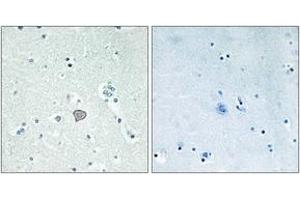 Immunohistochemistry analysis of paraffin-embedded human brain tissue, using ADORA2A Antibody.