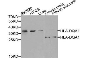 Western blot analysis of extracts of various cells, using HLA-DQA1 antibody. (HLA-DQA1 anticorps)