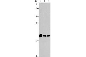 Gel: 15 % SDS-PAGE, Lysate: 40 μg, Lane 1-3: Mouse brain tissue, 231 cells, A375 cells, Primary antibody: ABIN7189902(ARL3 Antibody) at dilution 1/433, Secondary antibody: Goat anti rabbit IgG at 1/8000 dilution, Exposure time: 2 minutes