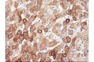 Immunohistochemical staining of paraffin-embedded Human liver tissue using anti-NHEJ1 mouse monoclonal antibody. (NHEJ1 anticorps)