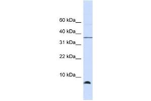HSPE1 antibody used at 1 ug/ml to detect target protein. (HSPE1 anticorps)