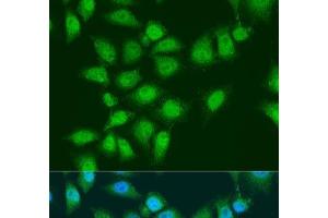 Immunofluorescence analysis of U2OS cells using EYA3 Polyclonal Antibody at dilution of 1:100.