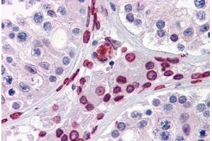 Human Testis: Formalin-Fixed, Paraffin-Embedded (FFPE) (WDR20 anticorps  (AA 1-570))