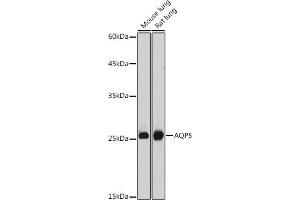 Western blot analysis of extracts of various cell lines, using  antibody (ABIN6133586, ABIN6137050, ABIN6137052 and ABIN6225252) at 1:1000 dilution. (Aquaporin 5 anticorps  (AA 150-250))