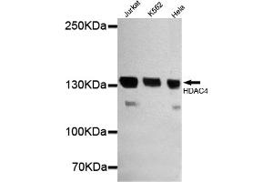 Western blot detection of HDAC4 in Jurkat,Hela and K562 cell lysates using HDAC4 mouse mAb (1:1000 diluted). (HDAC4 anticorps  (N-Term))