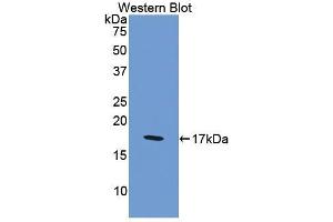 Detection of Recombinant F8, Human using Polyclonal Antibody to Coagulation Factor VIII (F8) (Factor VIII anticorps  (AA 2253-2346))