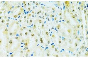 Immunohistochemistry of paraffin-embedded Mouse kidney using RCC1 Polyclonal Antibody at dilution of 1:100 (40x lens).