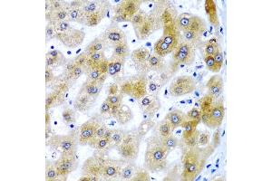 Immunohistochemistry of paraffin-embedded human liver damage using SECISBP2 antibody (ABIN6128699, ABIN6147497, ABIN6147498 and ABIN6222461) at dilution of 1:200 (40x lens). (SECISBP2 anticorps  (AA 585-854))