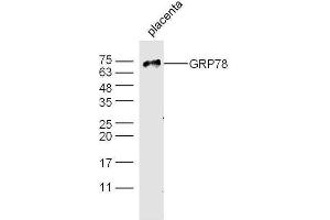 Mouse placenta probed with Rabbit Anti-GRP78 Polyclonal Antibody, Unconjugated  at 1:500 for 90 min at 37˚C. (GRP78 anticorps  (AA 251-360))