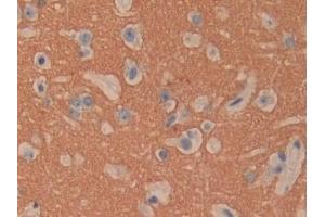 Detection of CD90 in Human Cerebrum Tissue using Polyclonal Antibody to Cluster of Differentiation 90 (CD90)