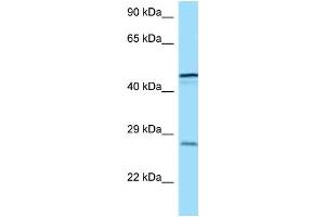 WB Suggested Anti-TREM1 Antibody Titration: 1. (TREM1 anticorps  (C-Term))