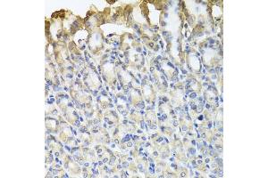 Immunohistochemistry of paraffin-embedded mouse stomach using TUBB8 antibody (ABIN5974843) at dilution of 1/100 (40x lens). (Tubulin, beta 8 anticorps)