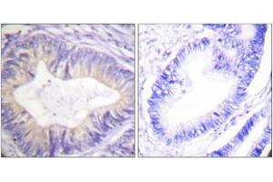 Immunohistochemistry (IHC) image for anti-Cas-Br-M (Murine) Ecotropic Retroviral Transforming Sequence (CBL) (AA 740-789) antibody (ABIN2888650) (CBL anticorps  (AA 740-789))