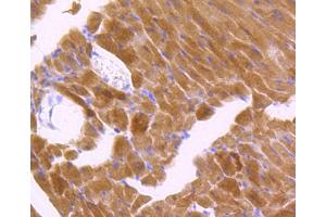 Immunohistochemistry of paraffin-embedded mouse heart using Phospho-JNK1/2/3-T183/T183/T221 antibody (abx125450) at dilution of 1/100 (40x lens).