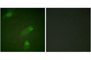 Immunofluorescence analysis of HeLa cells, using NF-kappaB p105/p50 (Ab-927) Antibody. (NFKB1 anticorps  (AA 896-945))