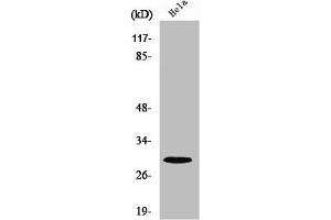 Western Blot analysis of COLO205 cells using Ribosomal Protein S4X Polyclonal Antibody